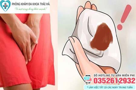 Vùng kín ra dịch nâu
