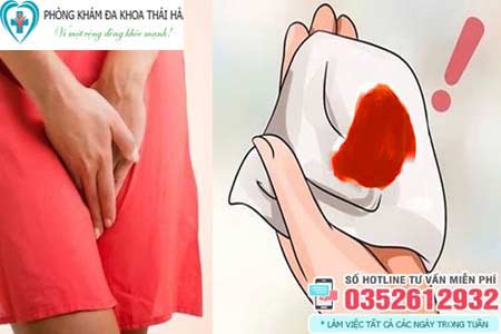 Chảy máu vùng kín bất thường là sao
