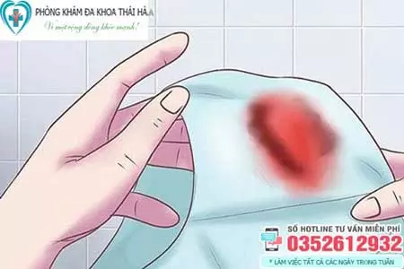 Chảy máu âm đạo bất thường
