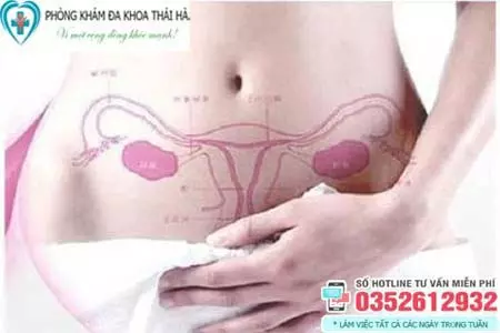 Viêm phụ khoa ở nữ giới