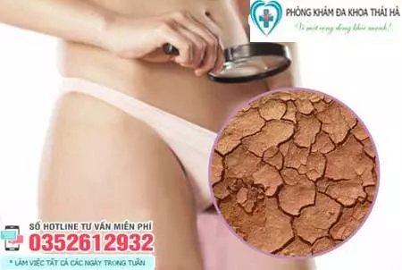 Nguyên nhân cô bé bị khô hạn