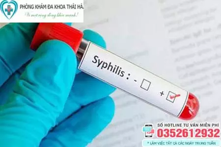 Chi phí xét nghiệm giang mai hết bao nhiêu tiền