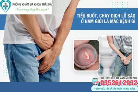 Đi tiểu buốt có mủ trắng ở nam giới