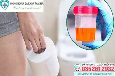 Đi tiểu đau rát ở nữ giới
