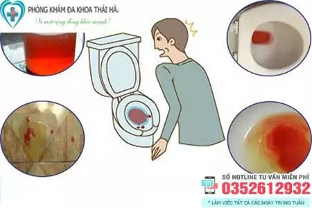Đi tiểu đau rát và ra máu