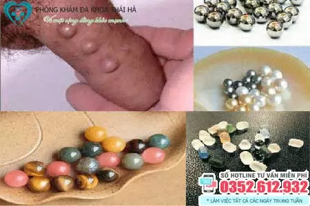 Tháo bi dương vật