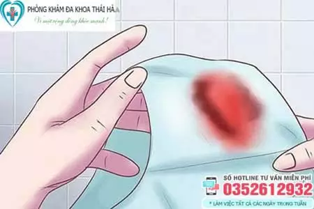 Sau quan hệ ra máu phải làm sao