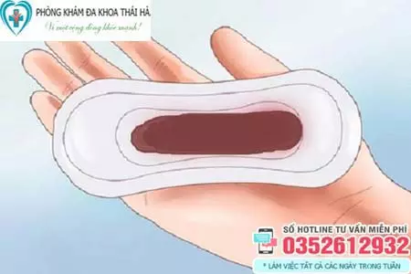 Hình ảnh khí hư màu nâu