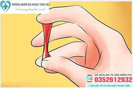 Hình ảnh khí hư có lẫn máu