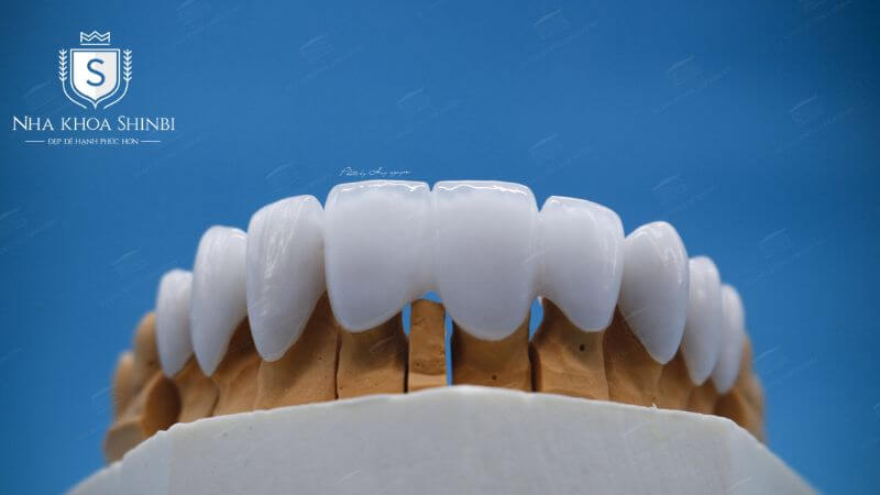 Giải đáp thắc mắc "Có nên bọc răng sứ Zirconia không?"