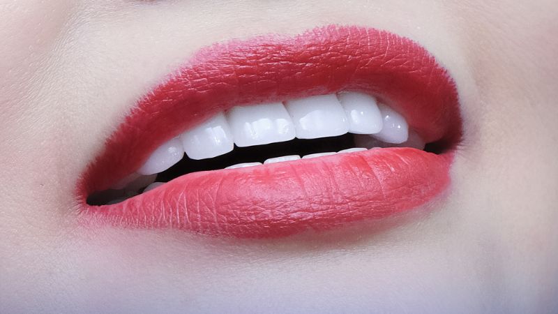 Bọc răng sứ thẩm mỹ