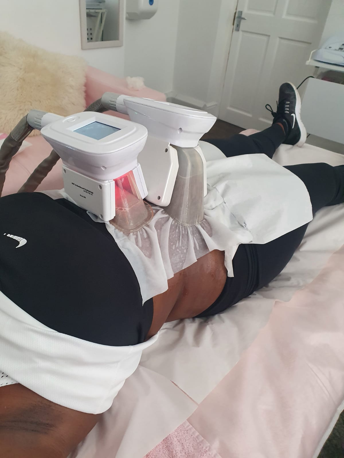 What is Fat Freeze ?