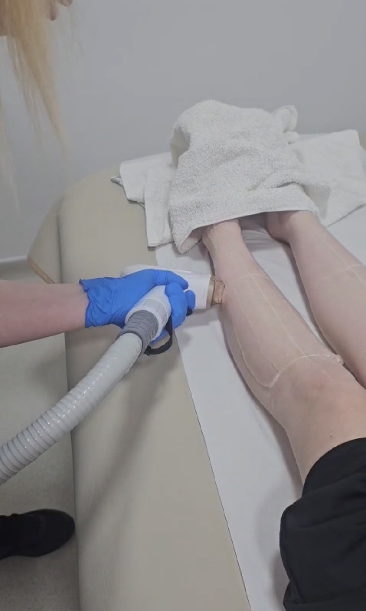 Smooth Confidence Starts Here: Advanced Laser Hair Removal