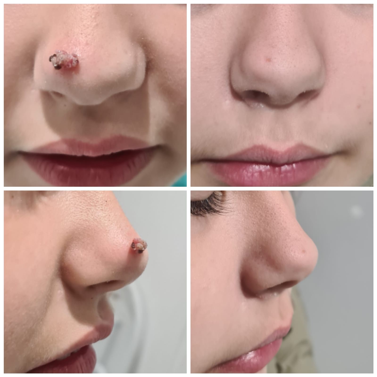 Common Skin Concerns: Myths, Facts and Modern Removal Treatments