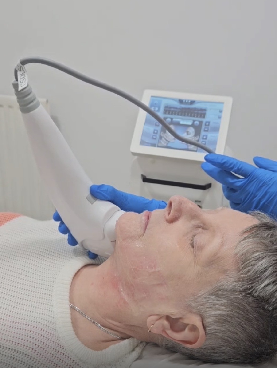 Lift, Tighten, Restore: The Power of HIFU