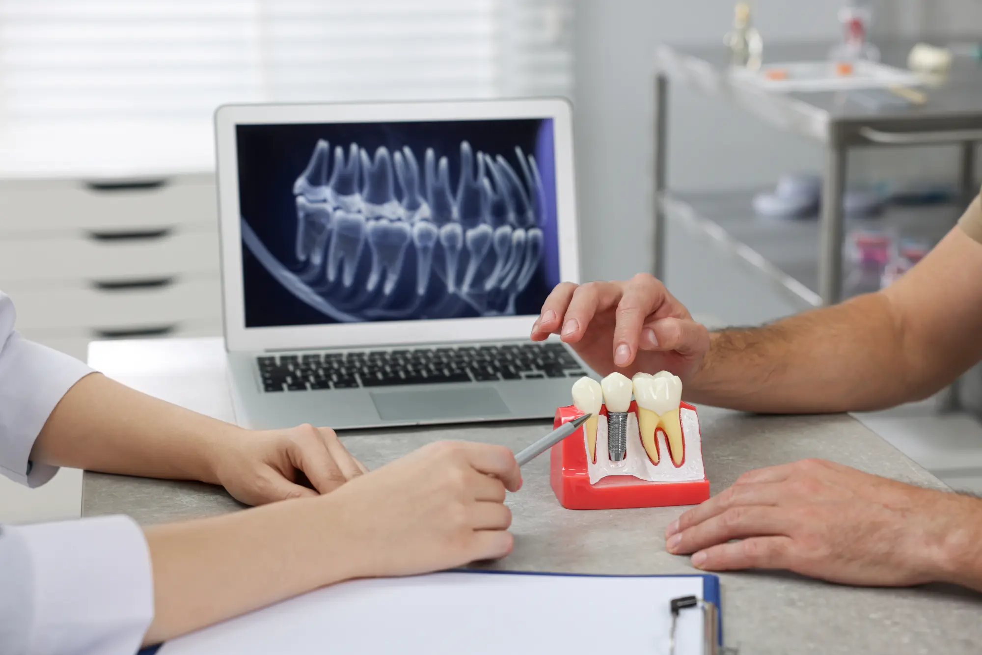 Dental Implants: The Gold Standard for Replacing Missing Teeth in Billerica