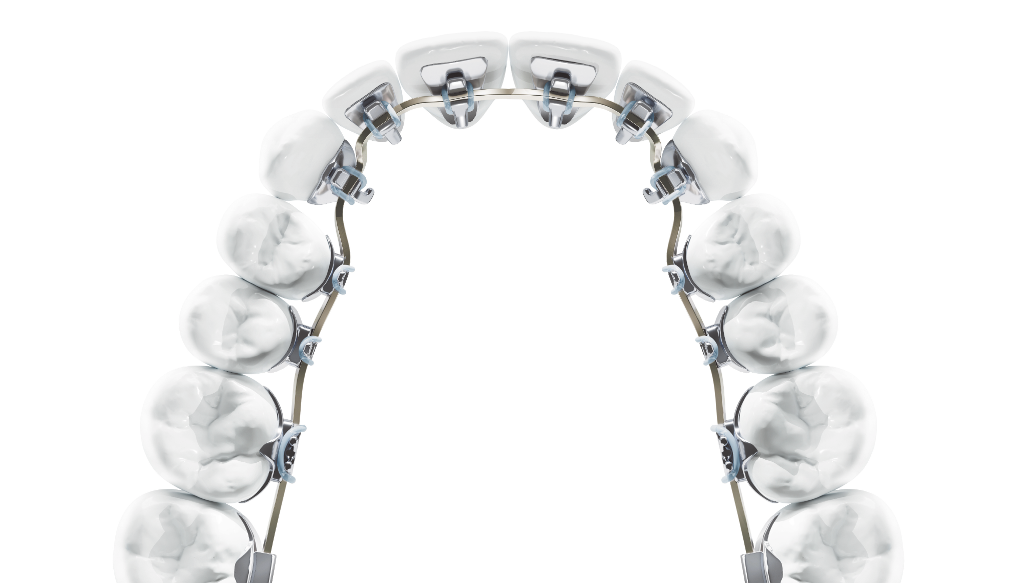 Braces Nobody Can See: A Nashville orthodontist's complete guide to lingual braces- cost, comfort, and candidacy.