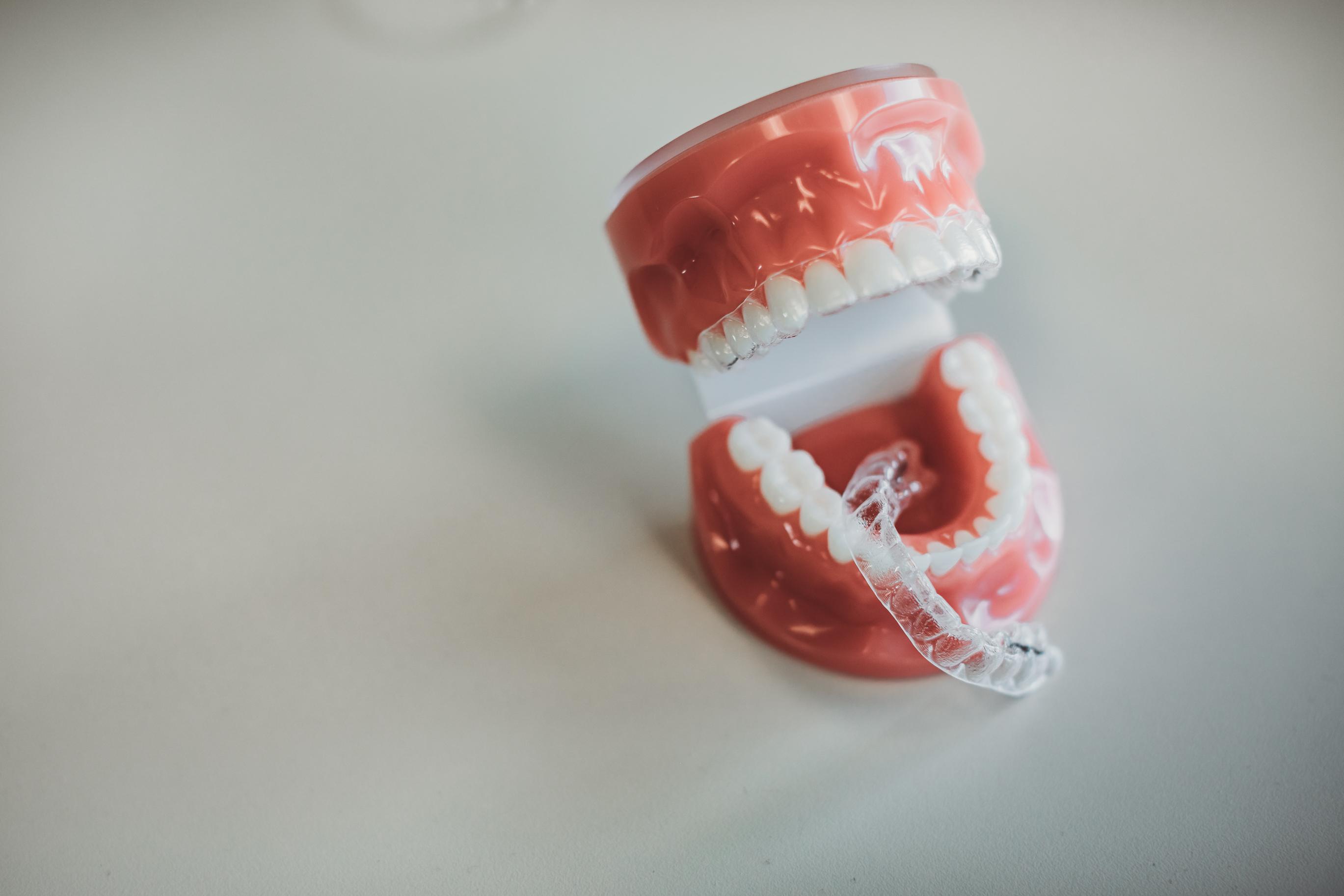 Clear Aligners at the Brentwood orthodontic office of Dr. Craig Starling