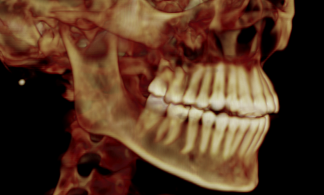 3D x-ray at Starling Orthodontics in Brentwood, TN