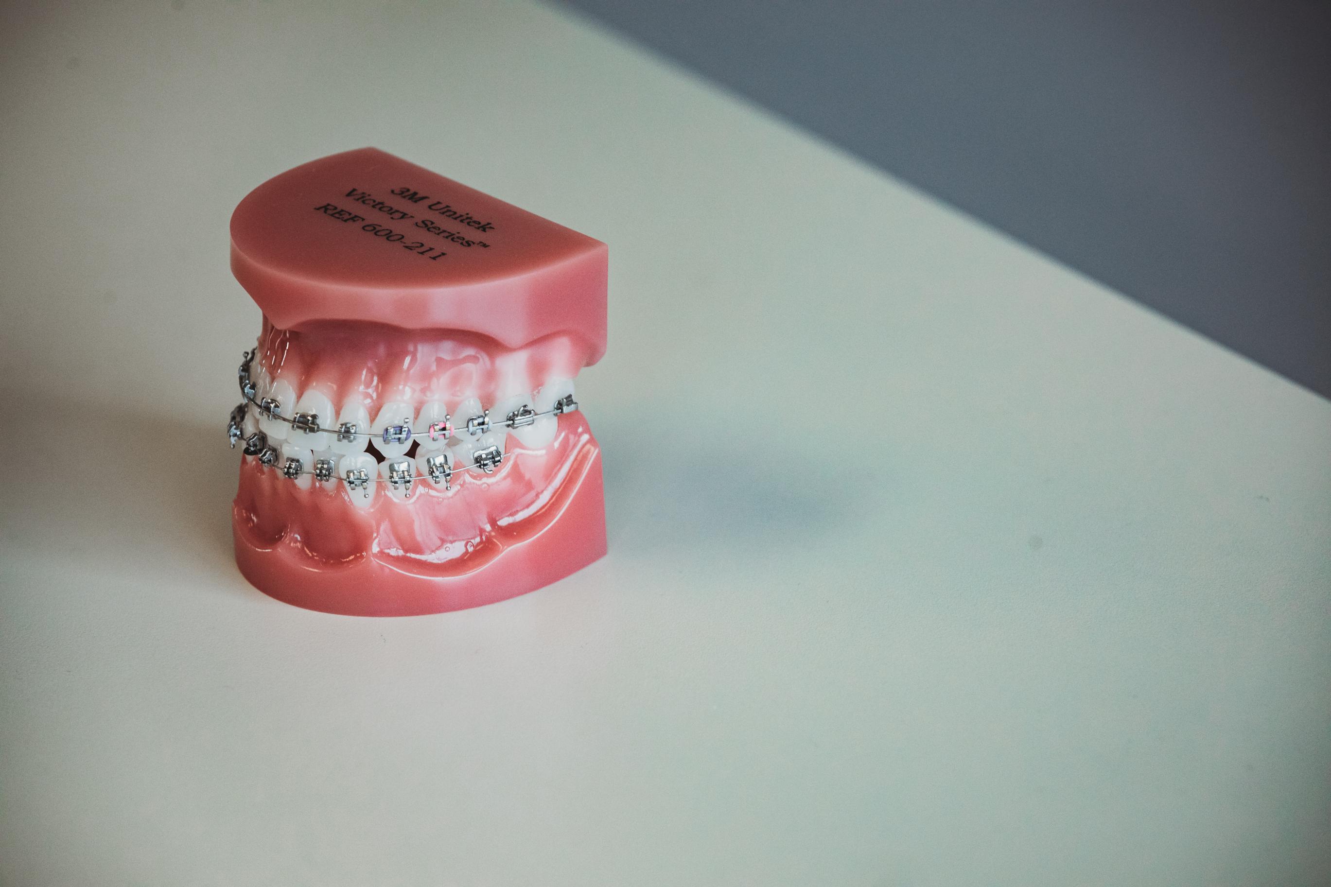 Traditional metal braces for orthodontic patients at Brentwood orthodontic office Starling Orthodontics