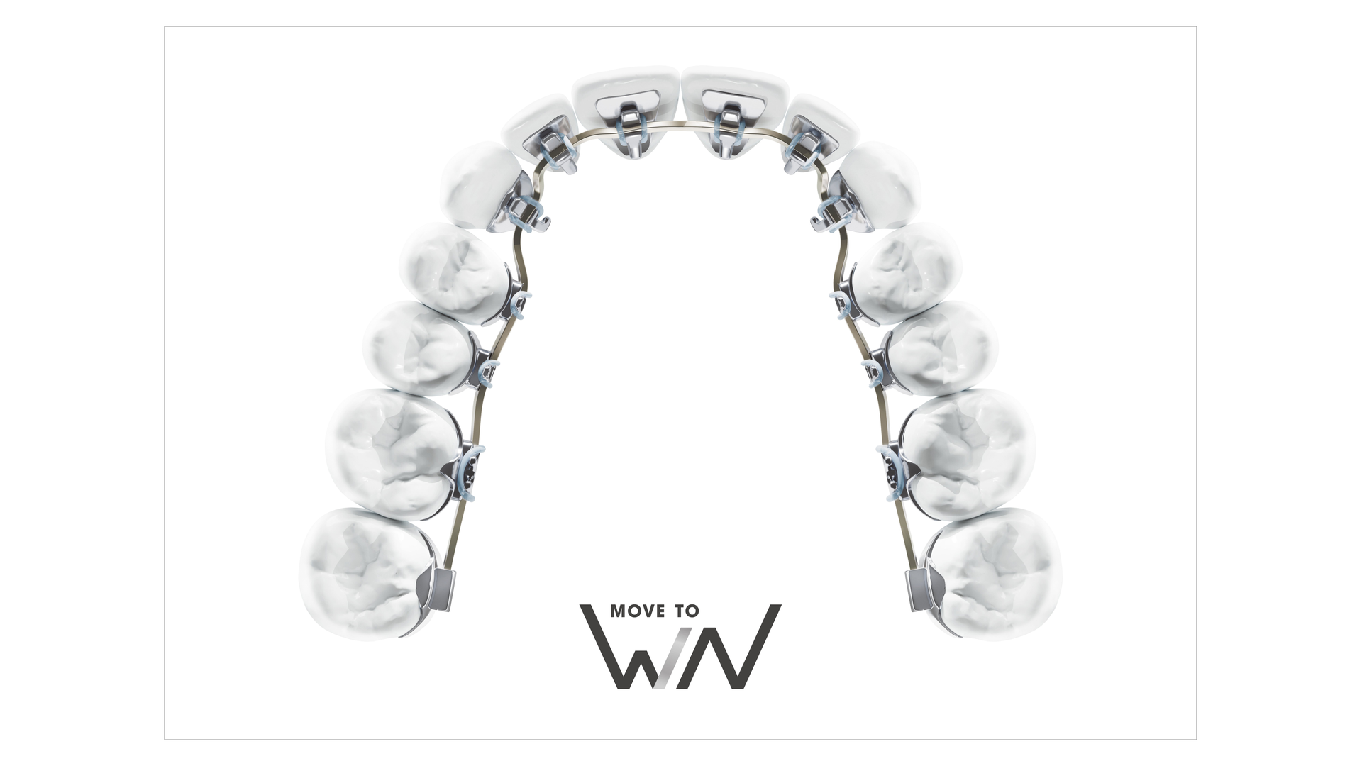 braces behind the teeth lingual braces at Starling Orthodontics