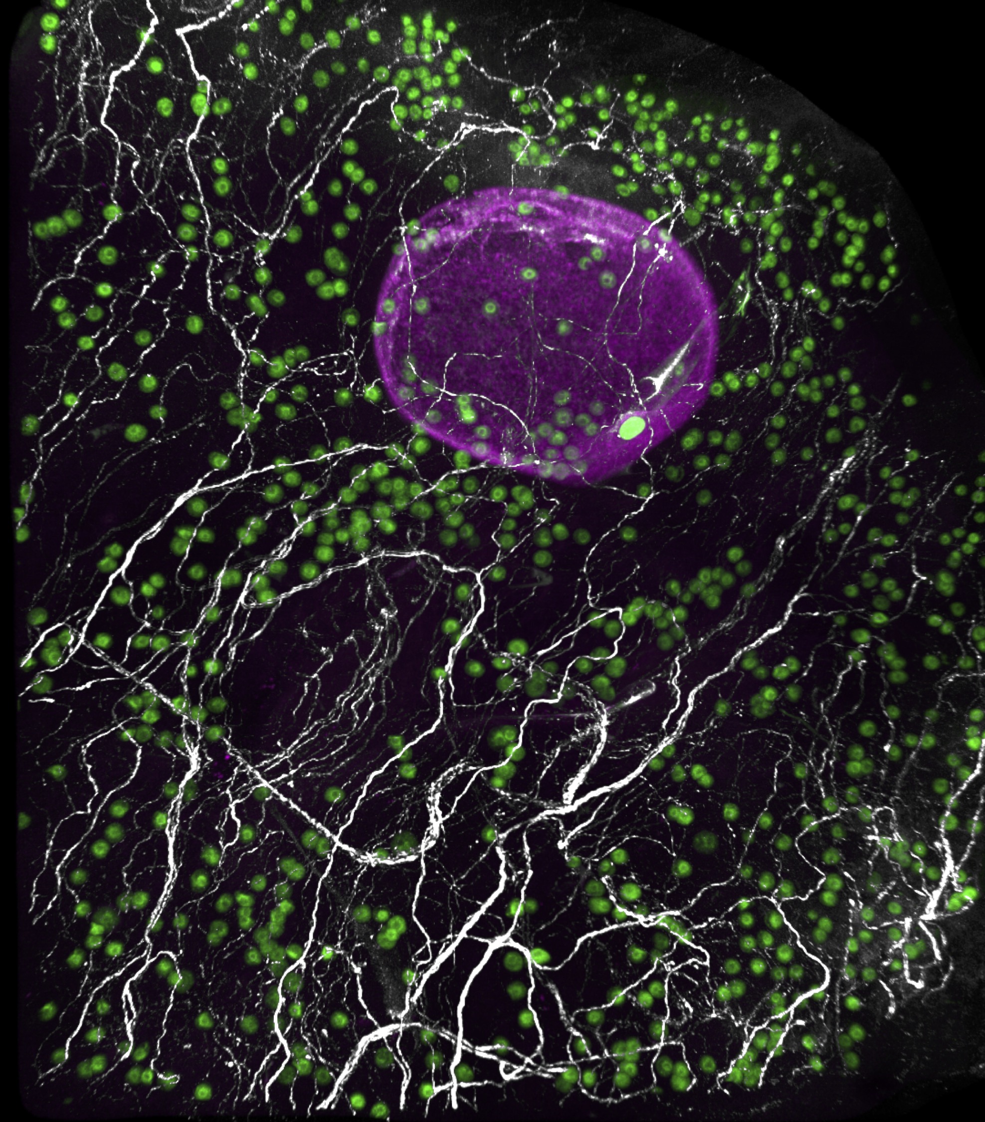 3D image of a human ovary with eggs (green), large growing follicle (magenta) and sympathetic nerves (white).