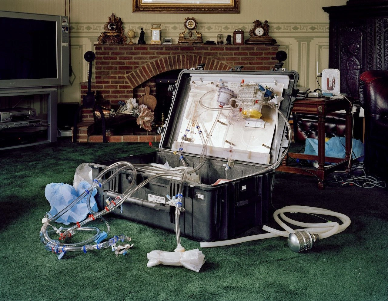 The Prospect of Immortality by Murray Ballard — A domestic interior disrupted by medical apparatus dominates the composition.