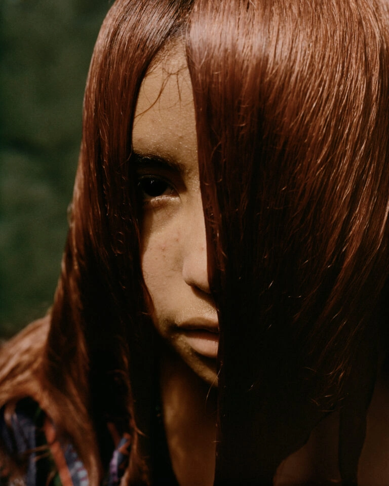 Genesis by Juan Brenner — A close-up portrait of a subject with albinism, their face partially obscured by long reddish-brown hair positioned across the frame.