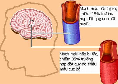 thuoc-dieu-tri-dot-quy-nao-1