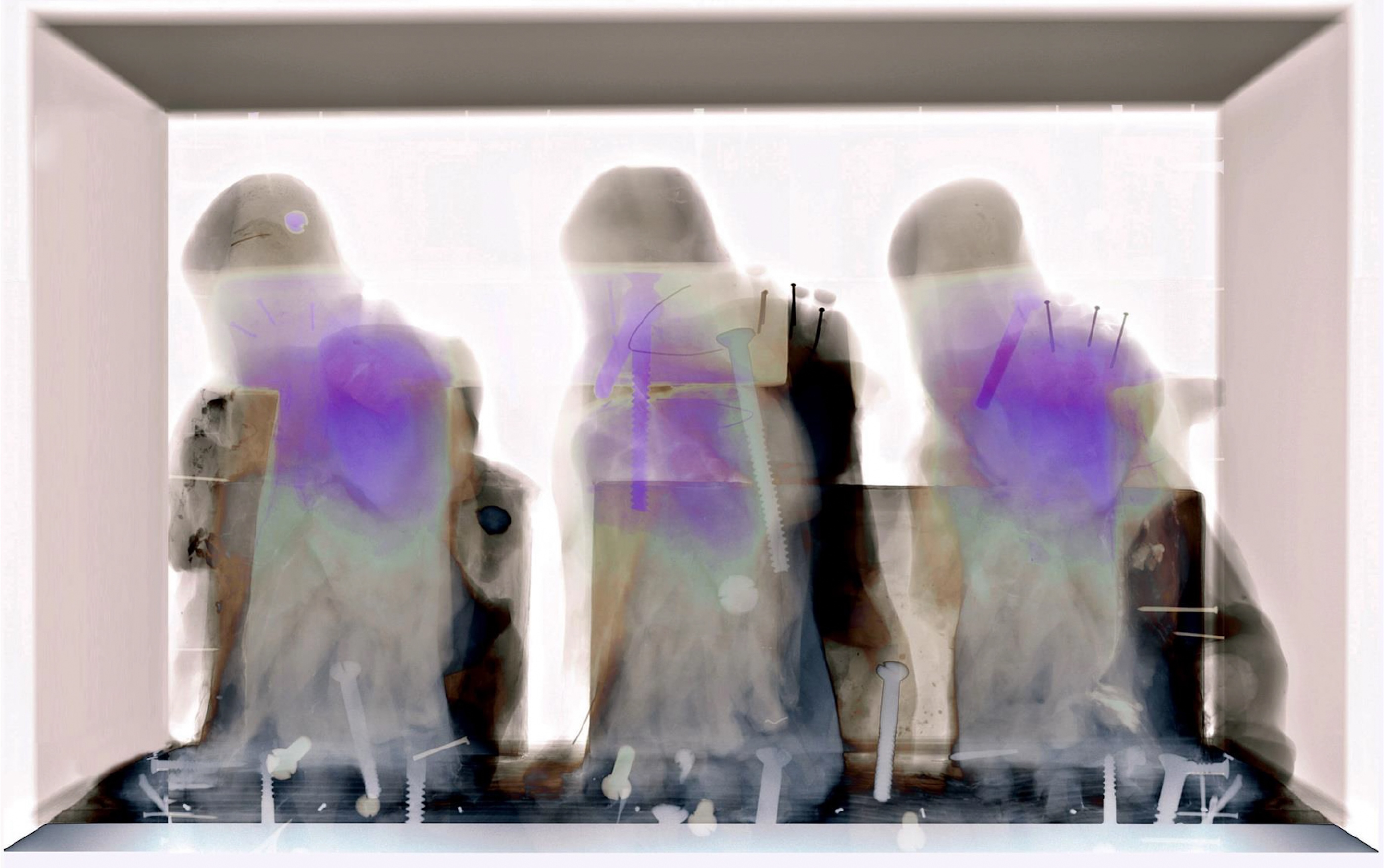 © Sue Ridge | X-rays- looking inside