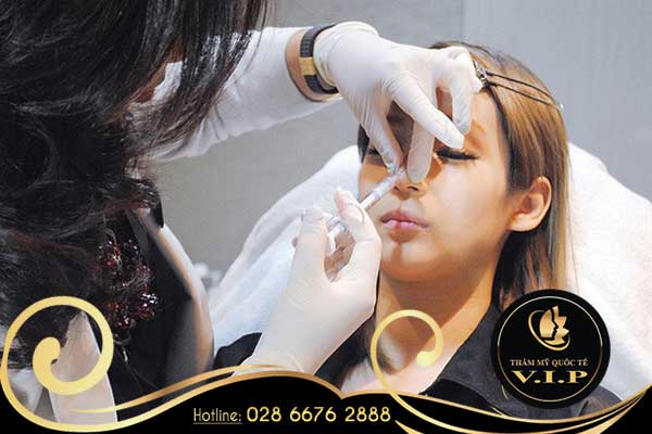 Tiêm Filler nâng mũi giá bao nhiêu