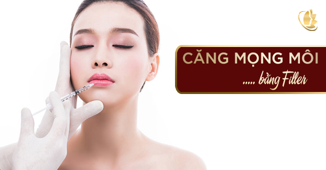 Filler - chất làm đẹp