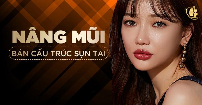 nâng mũi bán cấu trúc sụn tai