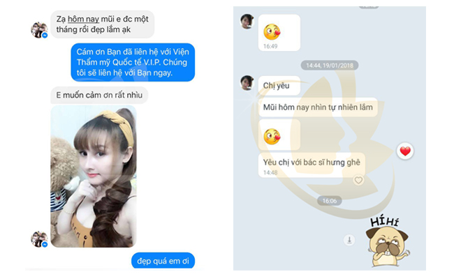 nâng mũi giá 9 triệu