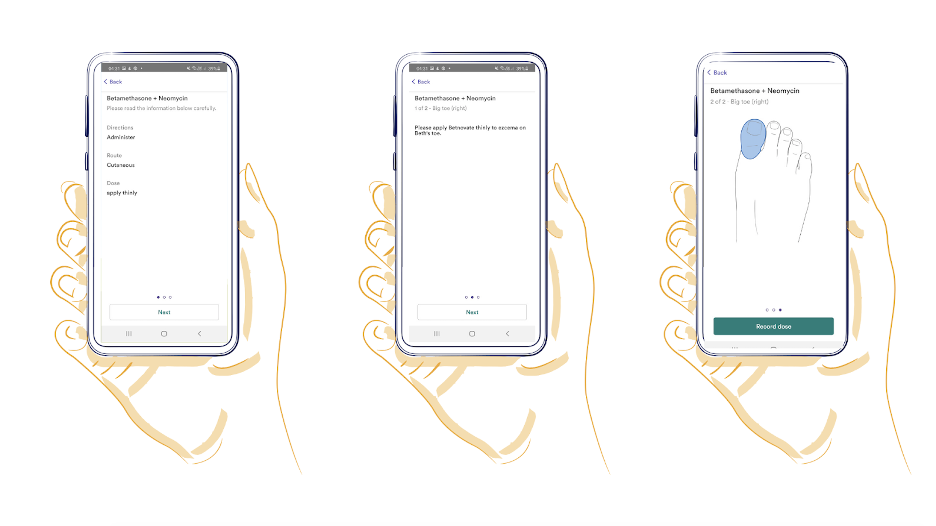 Three screens showing digital body maps on the Birdie App