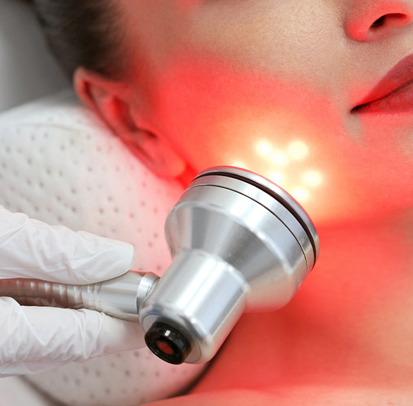 laser vein removal