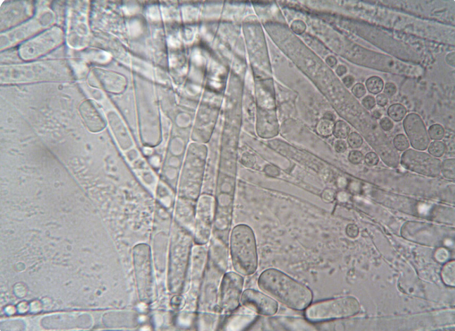 different colored and material dental fillings in a mouth