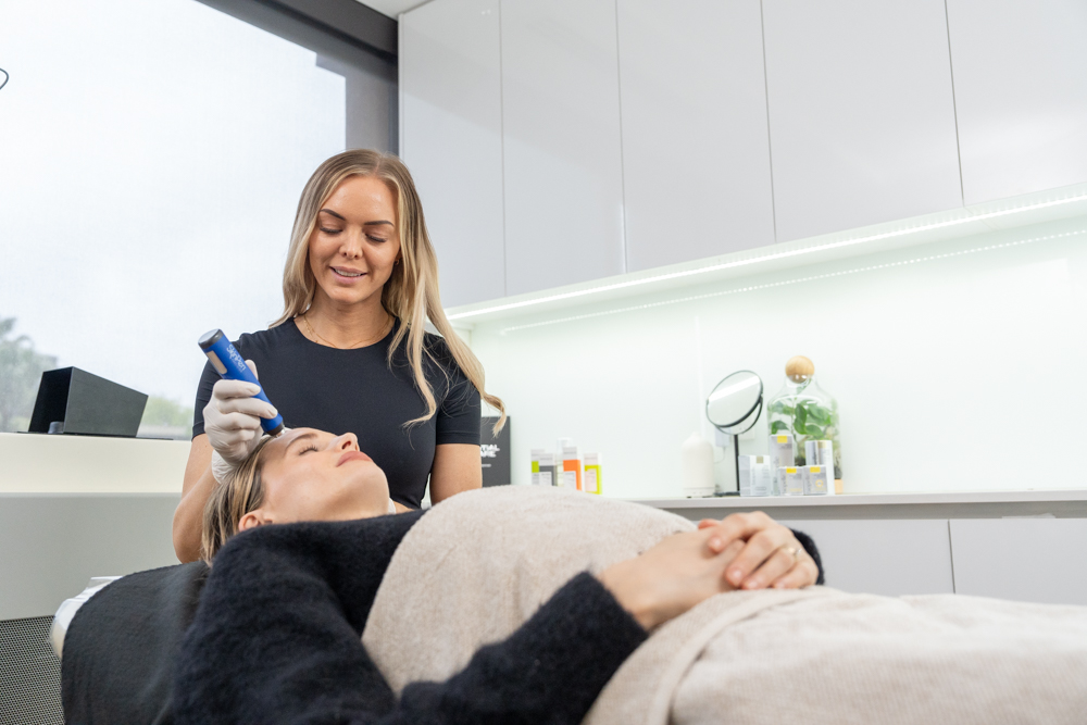 A client receiving Skin Pen microneedling as part of Victorian Dermal Group's Refine skincare package.