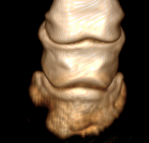 3D Darstellung einer Hornsäule