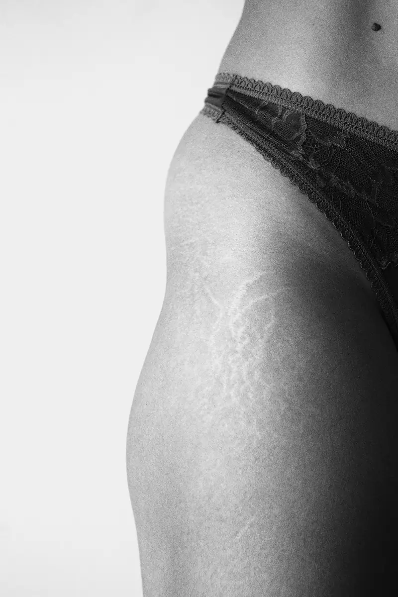 Cropped black and white photo highlighting hip dips and stretch marks on thigh