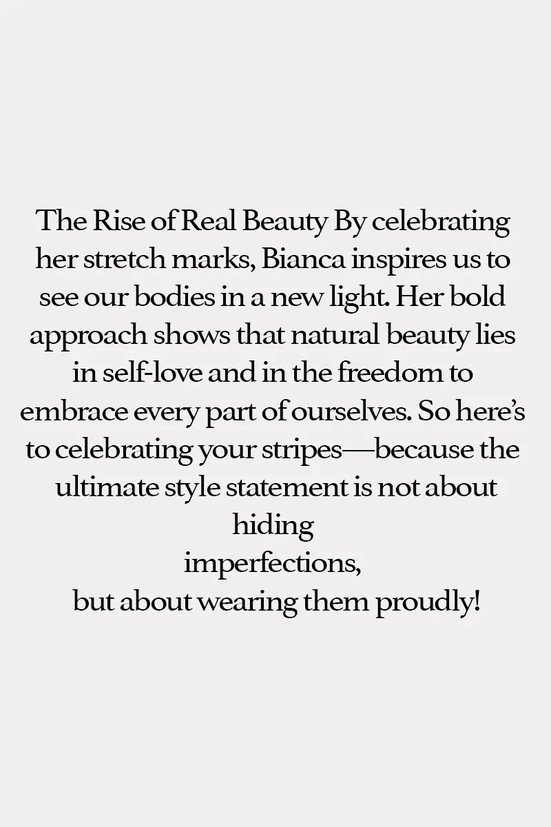 Quote about not hiding imperfections and embracing stretch marks with confidence.