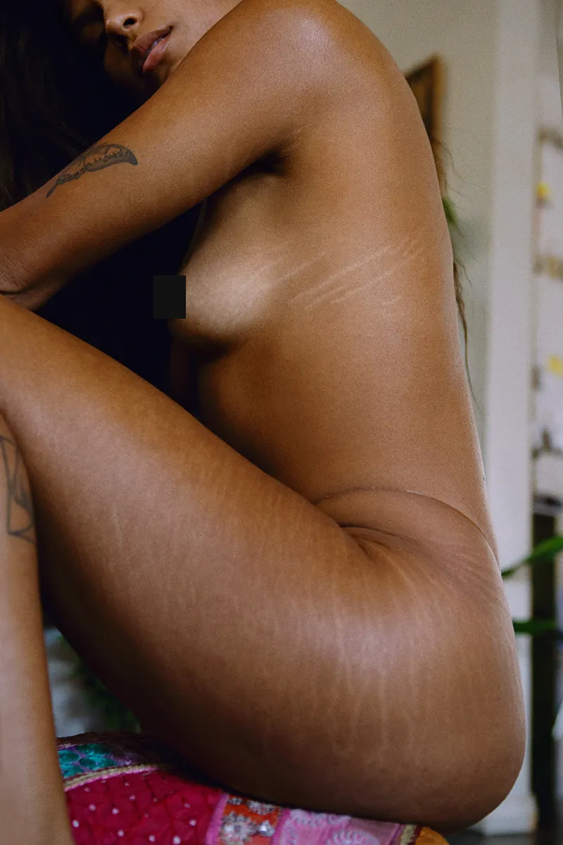 Color image of an artistic topless woman with visible stretch marks on her thighs and breasts, no makeup, embracing her natural body.