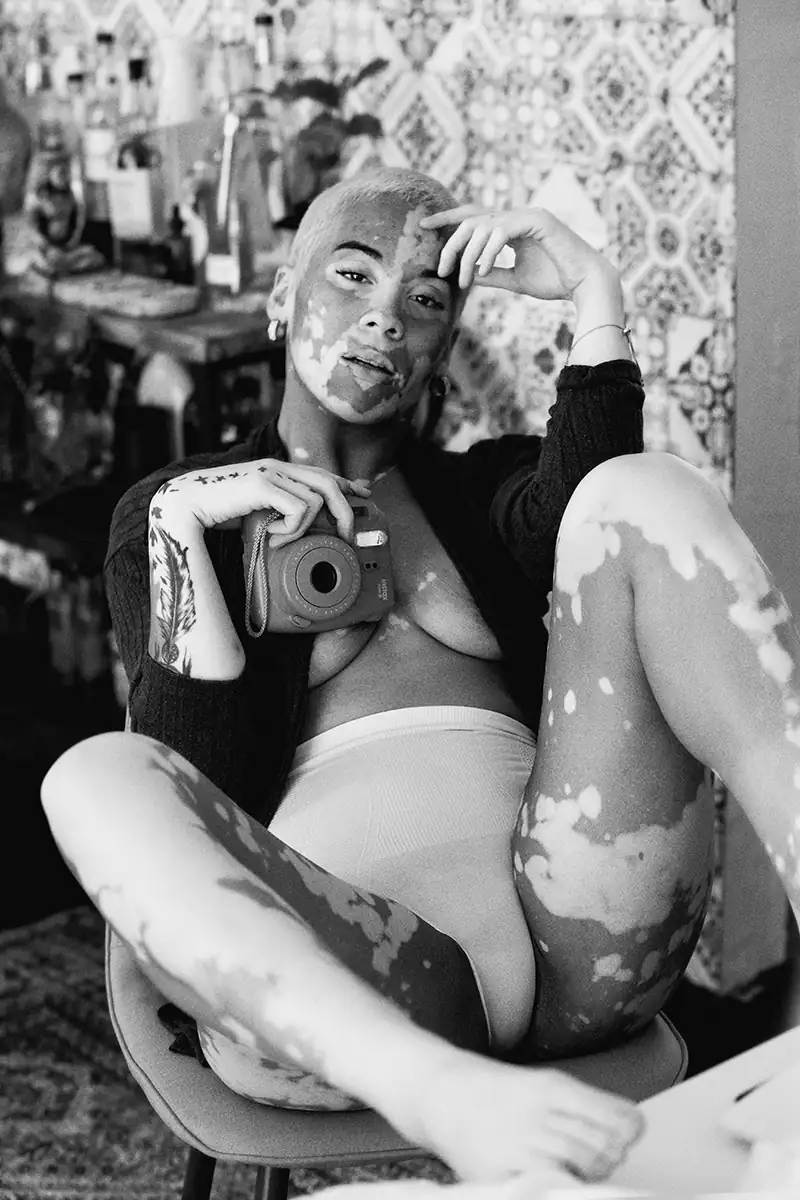 Artistic black and white portrait of Bailey with vitiligo, implied nude holding a Polaroid camera, wearing white underwear, natural skin with stretch marks and no makeup.