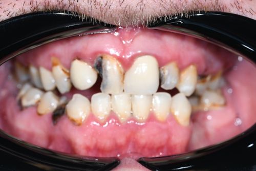 before and after treatment