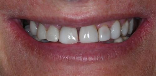 before and after treatment