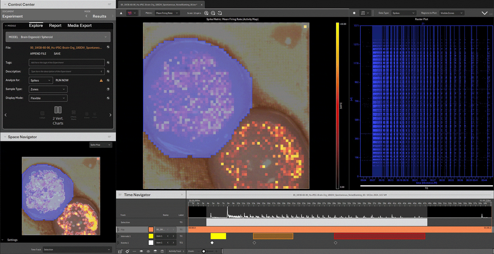 This screen recording showcases the powerful interactive analysis features of the 3Brain BrainWave 6 software, used here to study a sophisticated brain organoid model derived from iPSCs.

This powerful feature allows researchers to immediately isolate and compare the firing patterns of specific sub-networks or anatomical structures within a complex culture, providing critical insights into how different neural populations communicate.
