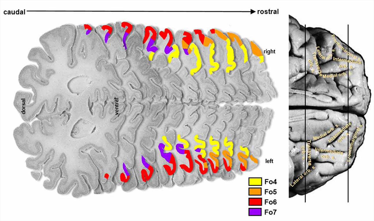 Localization of cytoarchitectonical areas Fo4, Fo5, Fo6, and Fo7 in the lateral orbitofrontal cortex, shown from in serial histological sections. (Wojtasik M et al., Front. Neuroanat., 2020)