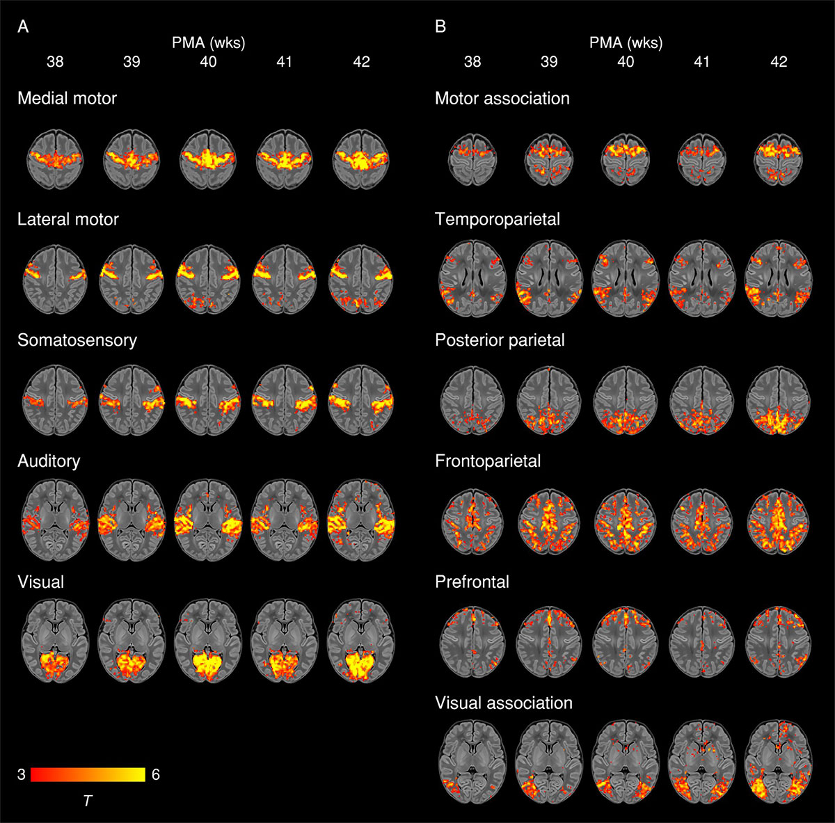 Functional network structures change weekly during development (Eyre M. et al., Brain, 2021)