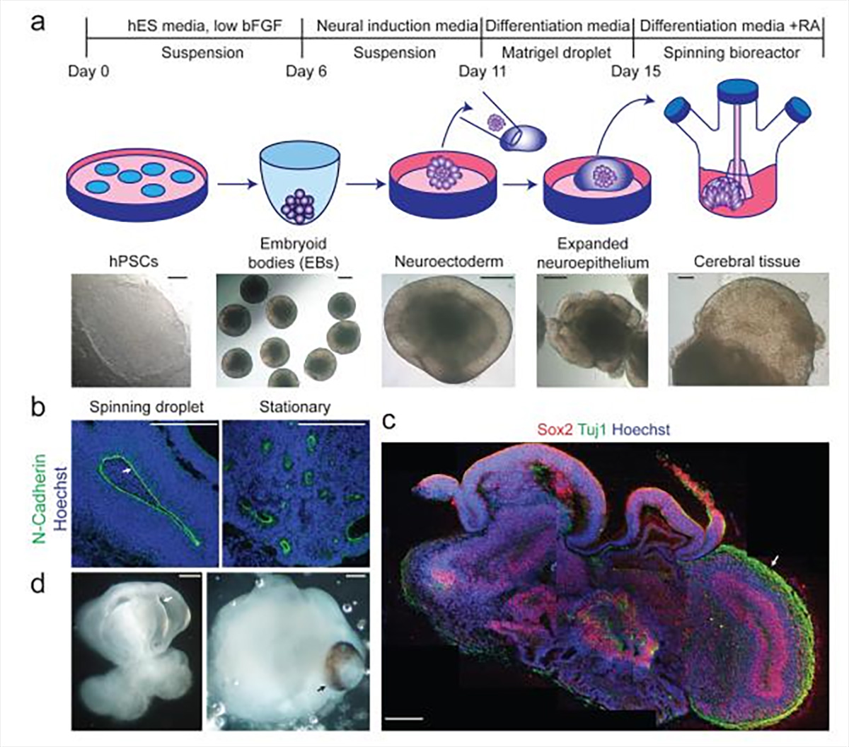 Different stages of cerebral organoid culture starting from human pluripotent stem cells. (Lancaster MA et al., Nature, 2013)