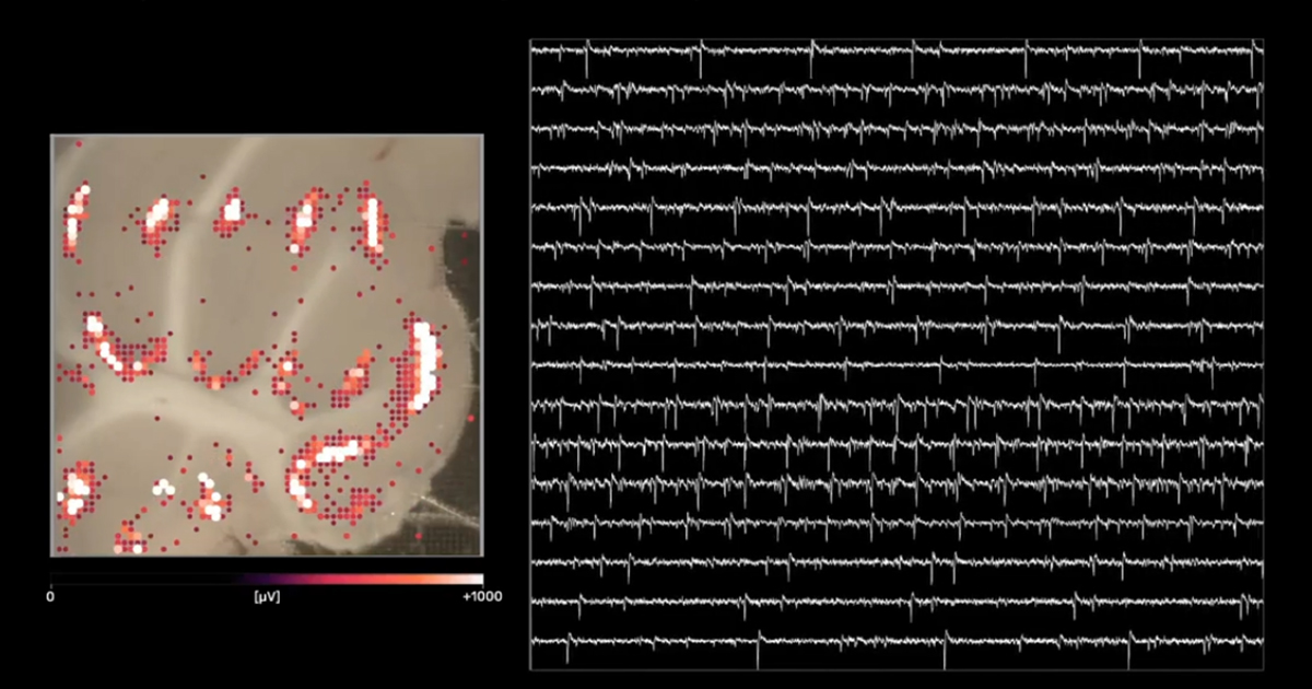 Spontaneous activity of Purkinje cells in a cerebellar brain slice. The spike signals on the right represent the mysterious “language” of intelligent networks. (Image: 3Brain AG)